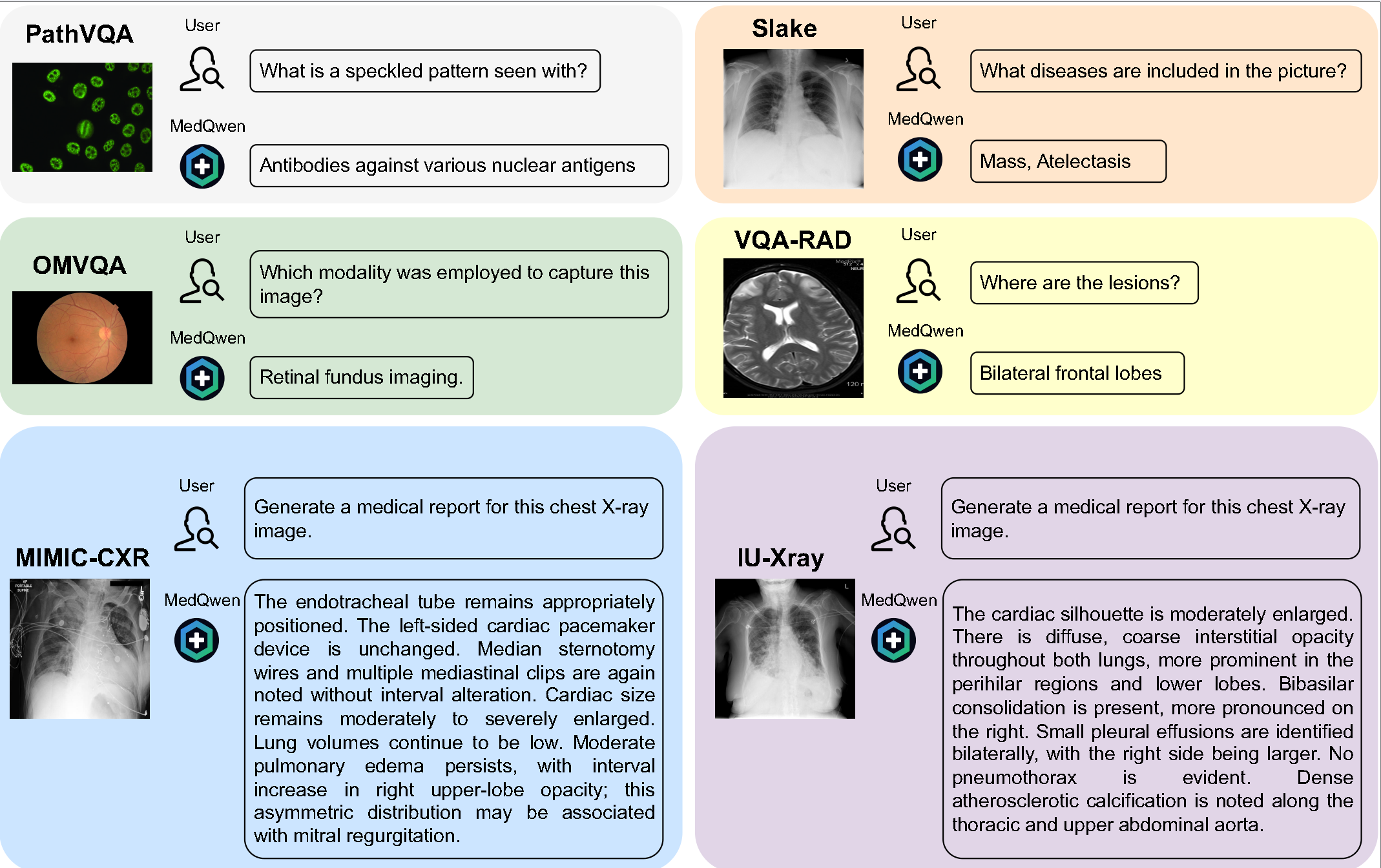 Qualitative examples